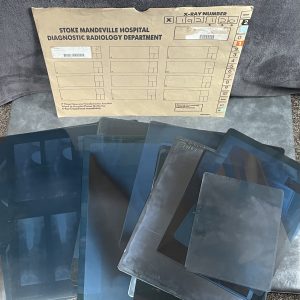 Collection of Twenty One Original Hospital Acetate Film X-rays